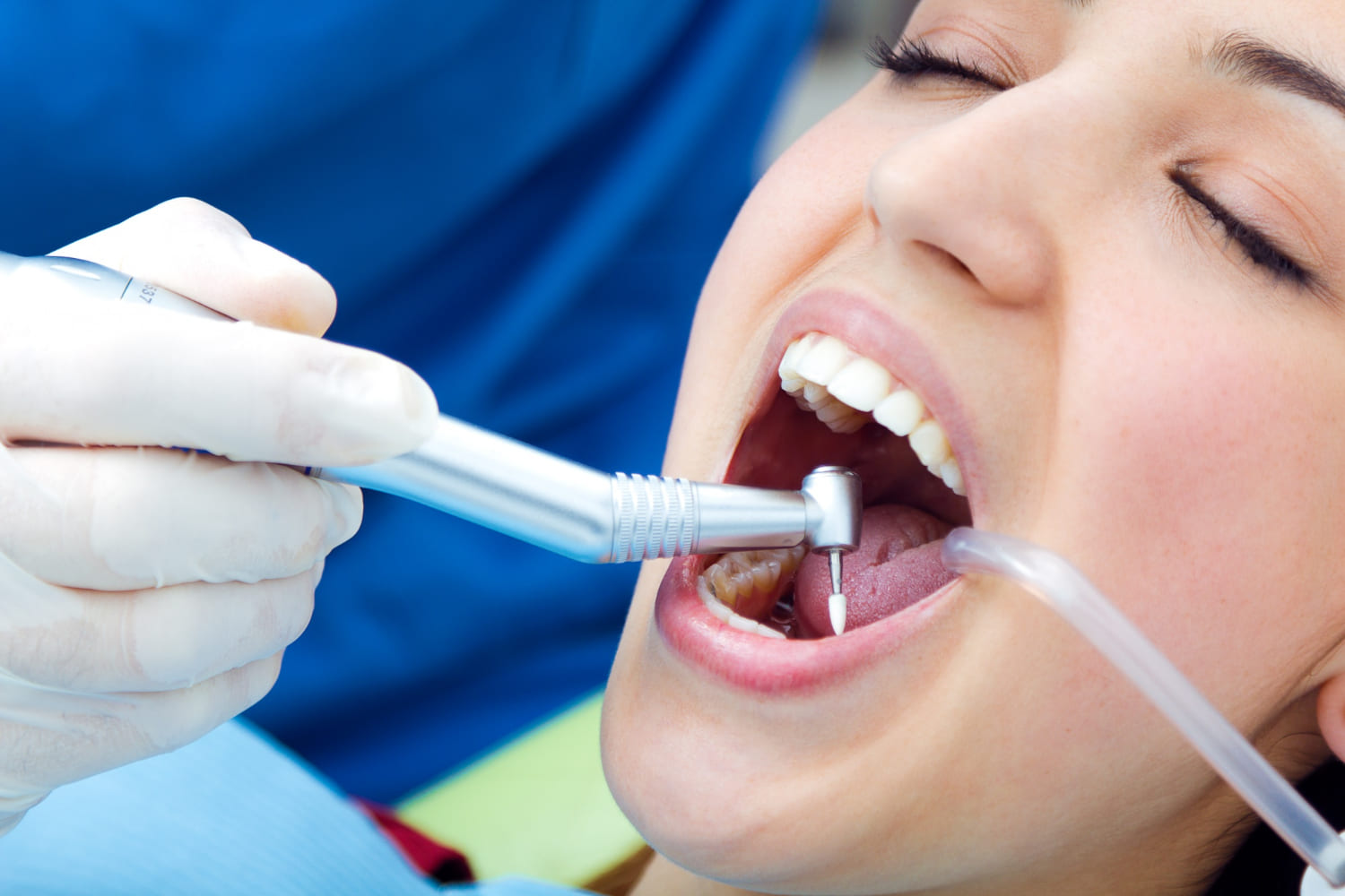 cada cuanto hay que hacerse una limpieza dental